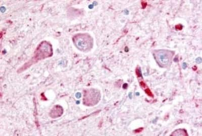 Immunohistochemistry: Wnt-8a Antibody [NBP3-14523] - Immunohistochemistry of thalamus, neurons and glia